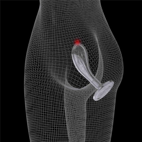 Flawless Clear Prostate Plug 6.0''